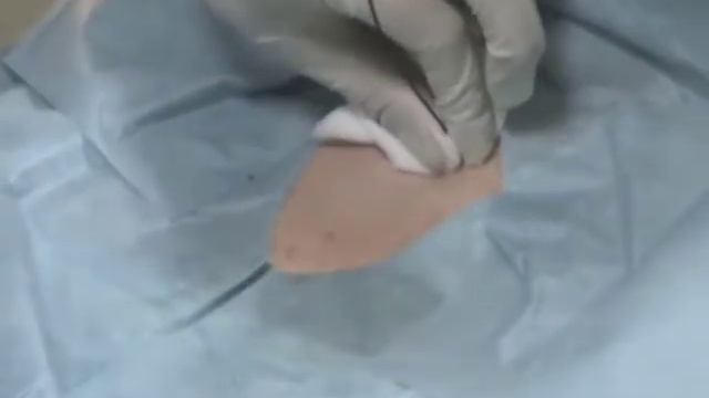 ПДТ Сигли-Григгз Портекс при ЧМТ+ВЧД мониторинг (8s)