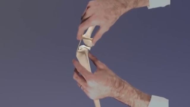 Cranial Cruciate Ligament Rupture - 3D Animation for Veterinary Undergraduates смотреть онлайн