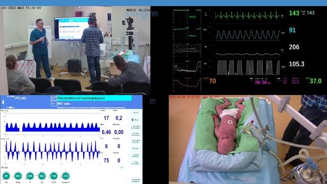 «Неонатальная респираторная поддержка с применением новейшего симулятора лёгких Lusi». Часть 3 смотреть онлайн