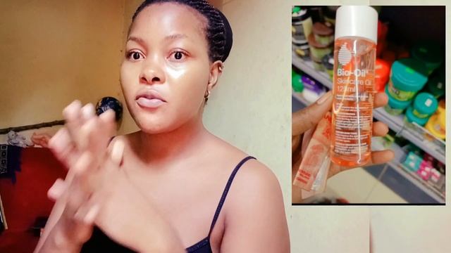 Bio Oil honest review before and after photos for stretch marks and scars смотреть онлайн