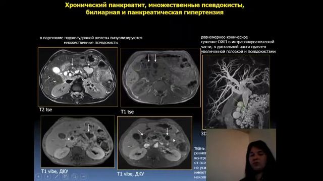 Доклад: "Неотложная МР-диагностика механических желтух" смотреть онлайн