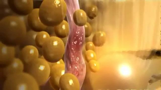 Manhattan Plastic Surgery, Body Contouring NYC смотреть онлайн