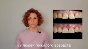 Почему световые пломбы лучше?