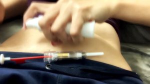 Золадекс  (Zoladex 3,6 mg)