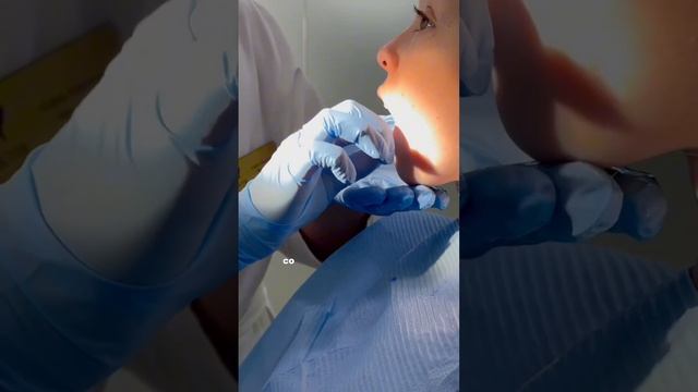 Что такое Твин-блок Съемный аппарат для лечения дистального прикуса смотреть онлайн