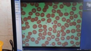 Подсчёт тромбоцитов по Фонио