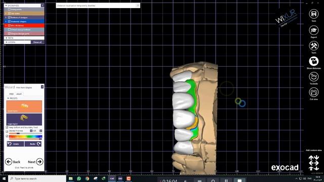 How to Design A Virtual Gingiva смотреть онлайн