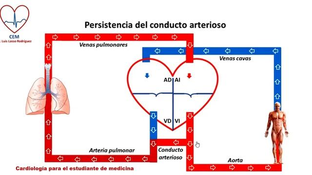 Circuito de la persistencia del conducto arterioso смотреть онлайн