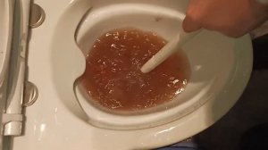 Устранение засора унитаза вантузом