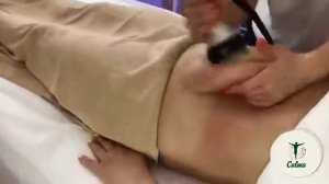 Аппаратный массаж+RF-лифтинг