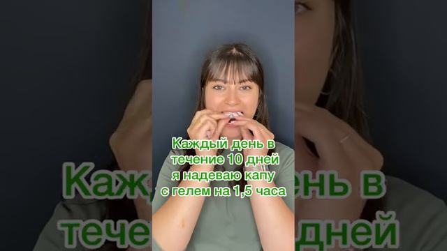 Как делается отбеливание зубов?