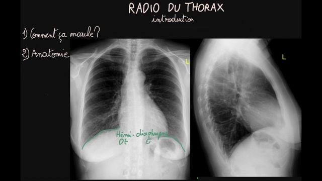 Radio du thorax - Introduction - Partie 1 - Docteur Synapse смотреть онлайн