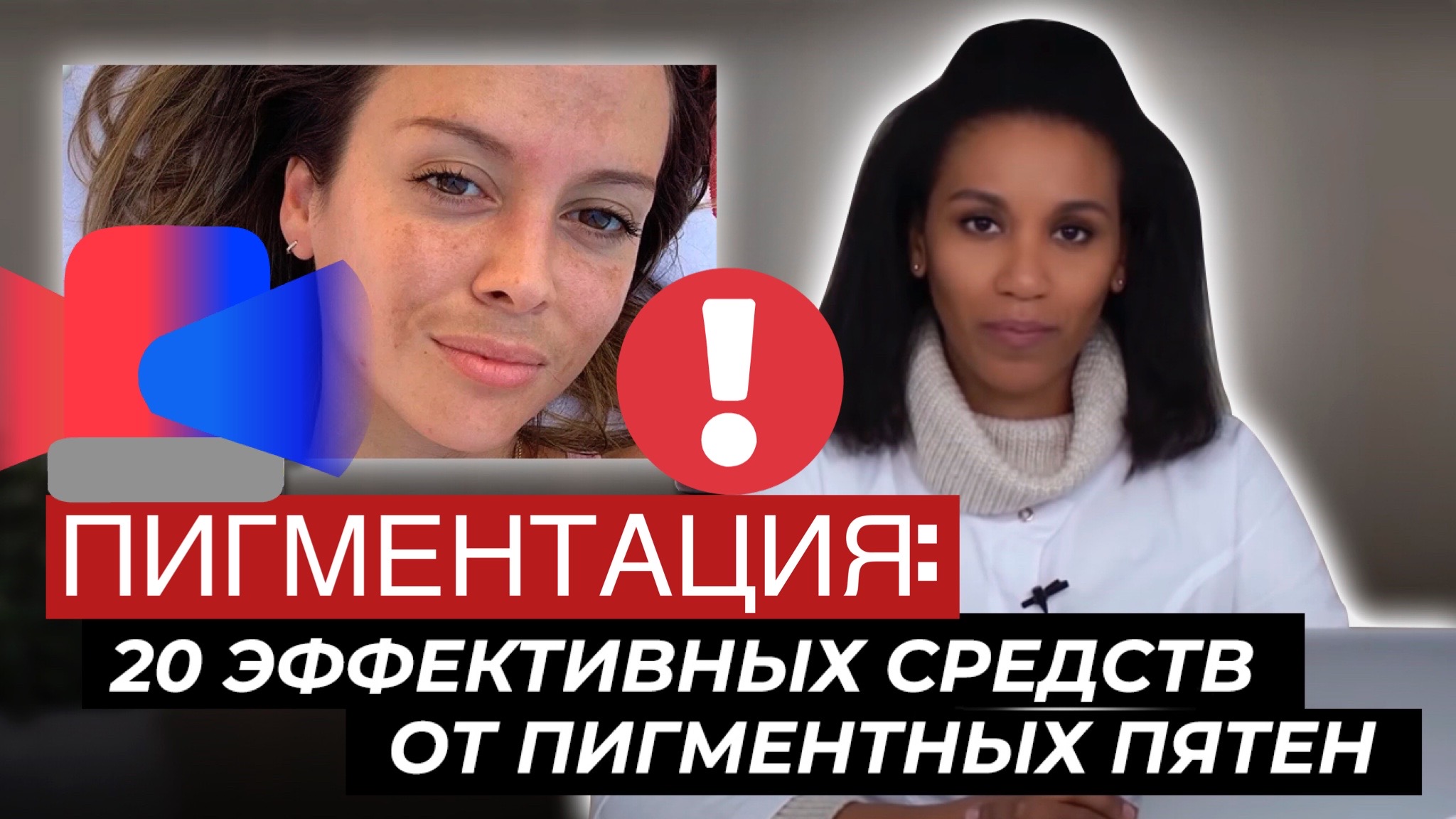 ПИГМЕНТАЦИЯ!!! Как осветлить пигментные пятна// Лучшие средства от пигментации смотреть онлайн