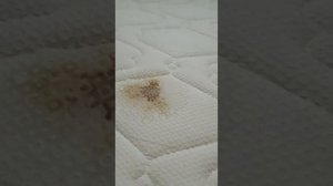Чем вывести пятна крови с матраса. Эрсаг ?