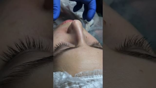 Контурная пластика. Базовый уровень. Практика