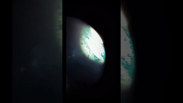 Так выглядит клетка растения ` хлопок` смотреть онлайн