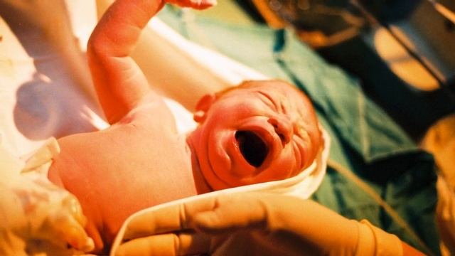 МЕТОДЫ РАСКРЫТИЯ ШЕЙКИ МАТКИ | Шейка матки во время родов смотреть онлайн