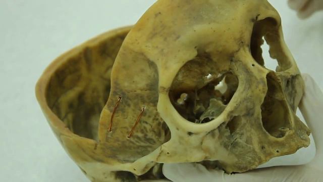 12. Полость носа - строение