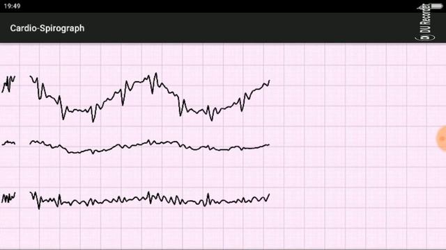 Cardio Spirograph free смотреть онлайн