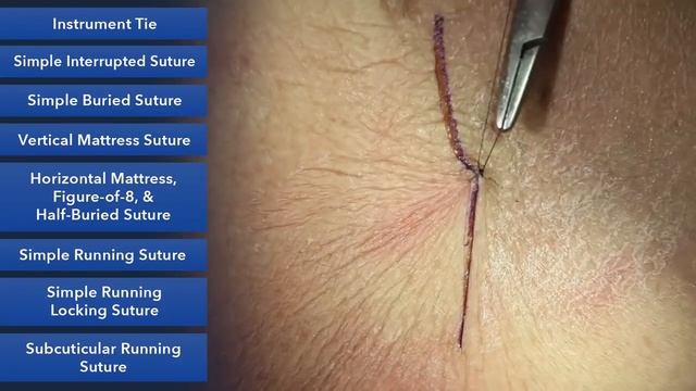 Instrument Tie And Square Knot - Learn Suture Techniques