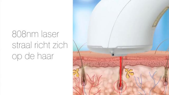 Домашний лазерный эпилятор Rio LAHC6 YES Laser смотреть онлайн