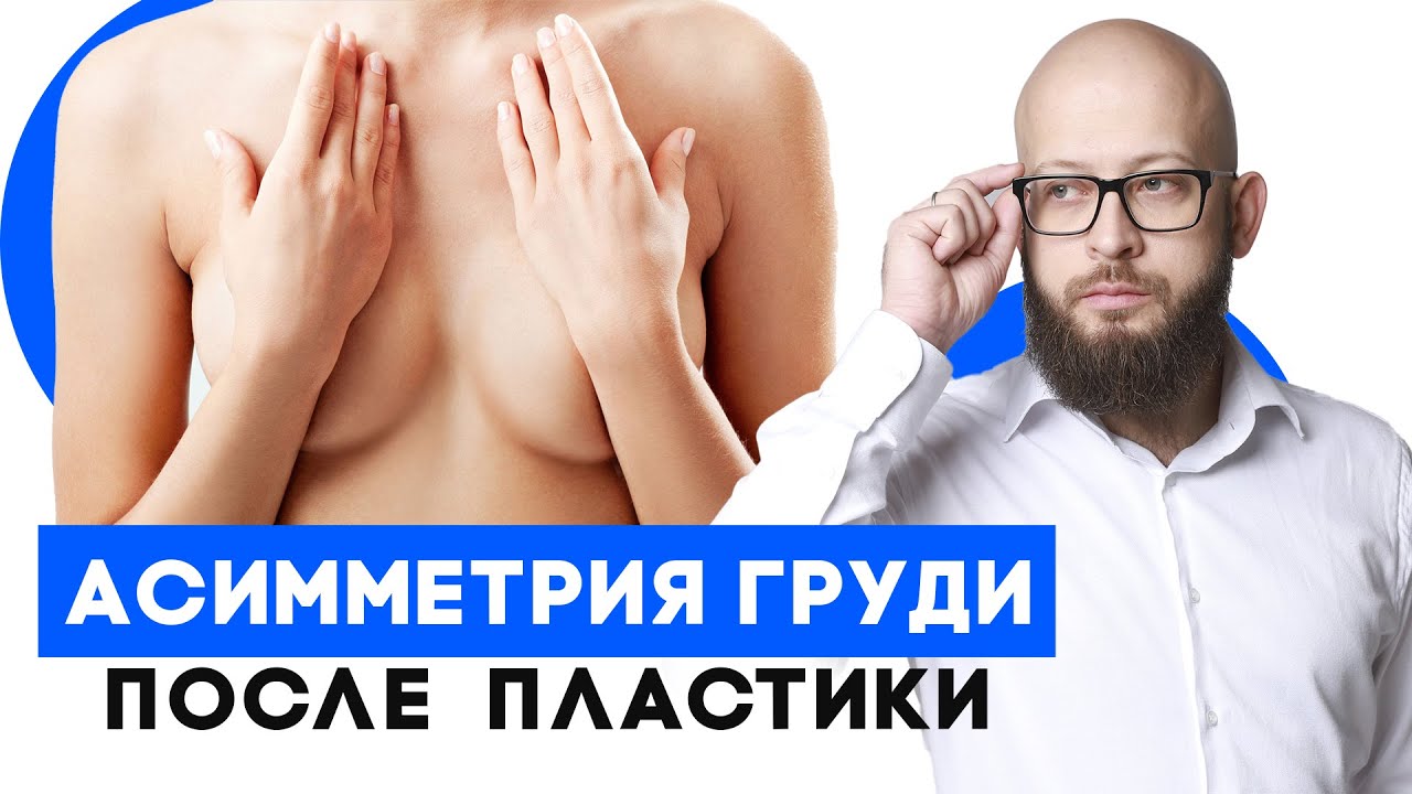 Избавиться от асимметрии груди раз и навсегда. Асимметрия молочных желез смотреть онлайн