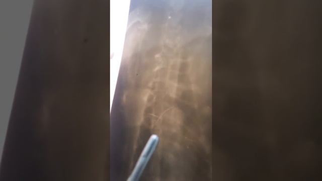 Игла в грудной клетке 2 смотреть онлайн