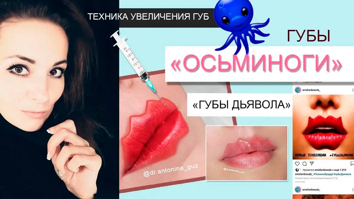Губы осьминоги / Губы дьявола / Техники Емельяна Брауде / octopus lips / devil's lips смотреть онлайн