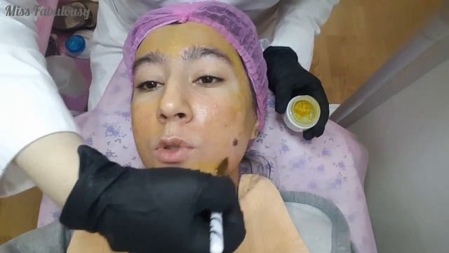 ЖЕЛТЫЙ ПИЛИНГ ЛИЦА/ РЕТИНОЛОВЫЙ ПИЛИНГ - весь процесс смотреть онлайн