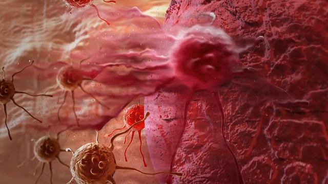 Tienes los Glóbulos Blancos (Leucocitos) Bajos - Ignorando esta Señal de Peligro en tu Sangre смотреть онлайн
