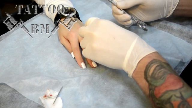 Установка микродермала в палец Installation microdermal finger смотреть онлайн