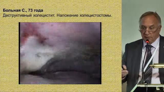 О.Э. Луцевич - Новые решения старых проблем: острый холецистит у больных старческого возраста.