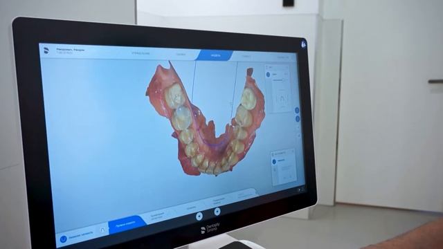 Шаповалов Альберт Сергеевич о внутриротовом сканере Sirona Primescan и вообще о сканировании зубов смотреть онлайн