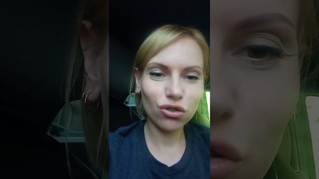 брекеты 5 мес, выравнивание клыка