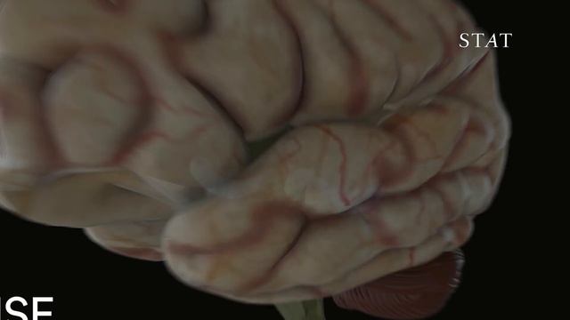 The science of opioid withdrawal смотреть онлайн