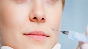 Коррекция носогубных складок