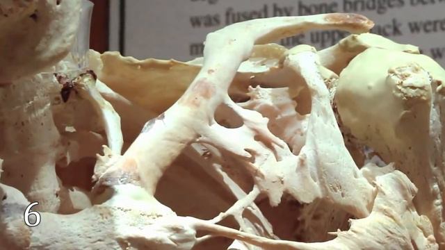 10 БЕЗУМНЫХ МУТАЦИЙ ЧЕЛОВЕКА | Мутация Человека | Полезно знать