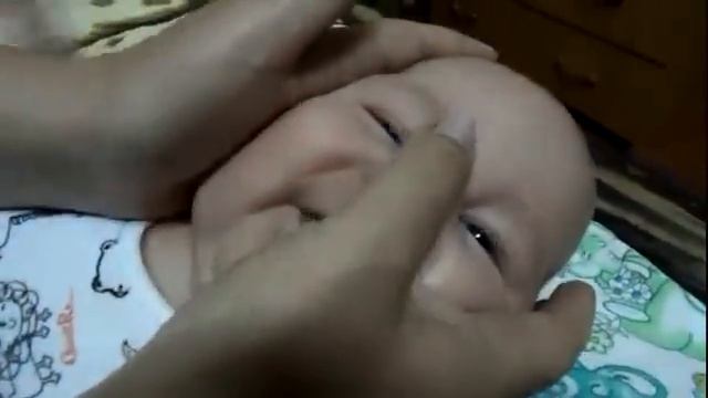 Непроходимость слезного канала.Закисает глазик.Дакриоцистит. Массаж глазика. смотреть онлайн