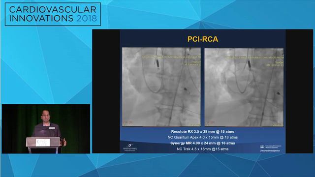 CVI2018 Session: When to use hemodynamic support & device selection - Ajay Kirtane, MD смотреть онлайн