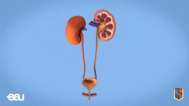 Ударно-волновая литотрипсия (EAU - SWL RU) смотреть онлайн