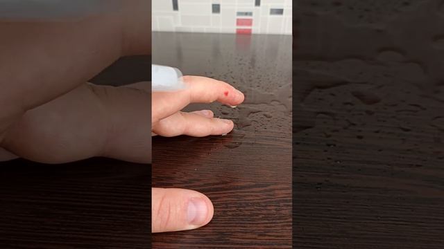 Как избавиться от укуса хомяка. Последствия укуса смотреть онлайн