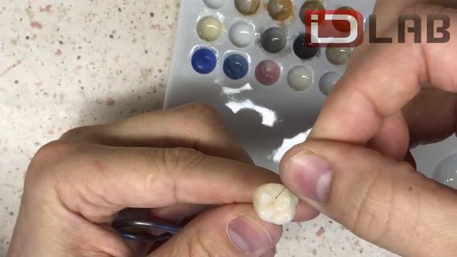 Раскраска 16 зуба из пресскерамики смотреть онлайн