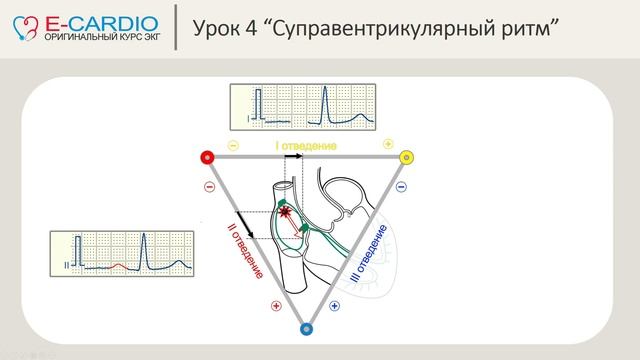 Урок №4 - "Суправентрикулярный ритм" смотреть онлайн