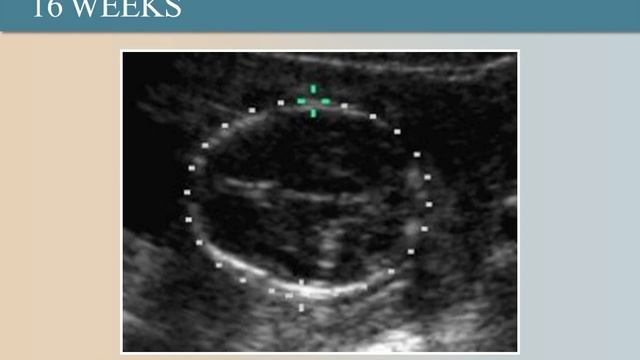 6_Ultrasound Training смотреть онлайн