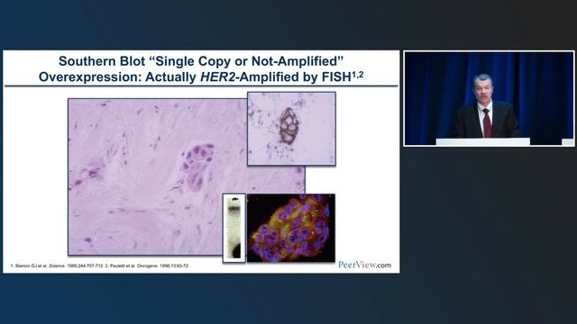 Biomarker Testing for New Therapeutic Options Targeting HER2, HER3, and TROP2 in Solid Tumors смотреть онлайн