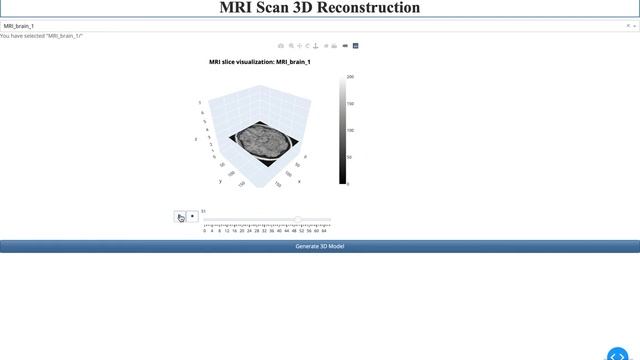 MRI Scan 3D Reconstruction using Computer Vision смотреть онлайн