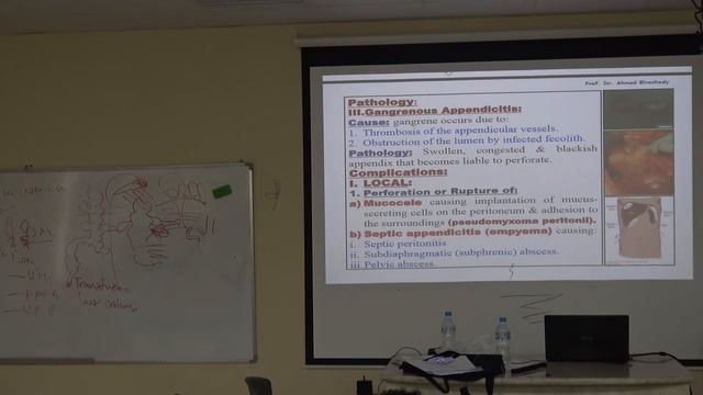 PATH. Inflammatory Lower GIT Diseases Dr. Ahmed El-Rashedy 3rd year смотреть онлайн