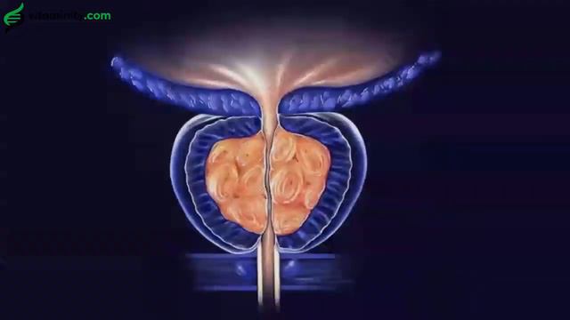 Ajuga Reptans against baldness and benign prostatic hypertrophy смотреть онлайн