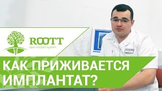 ☝ Как и сколько времени длится приживление импланта. Признаки отторжения имплантата. смотреть онлайн
