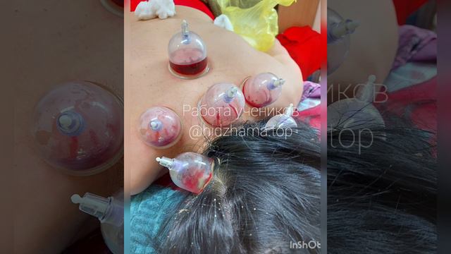 Обучение хиджаме с выдачей сертификата. смотреть онлайн